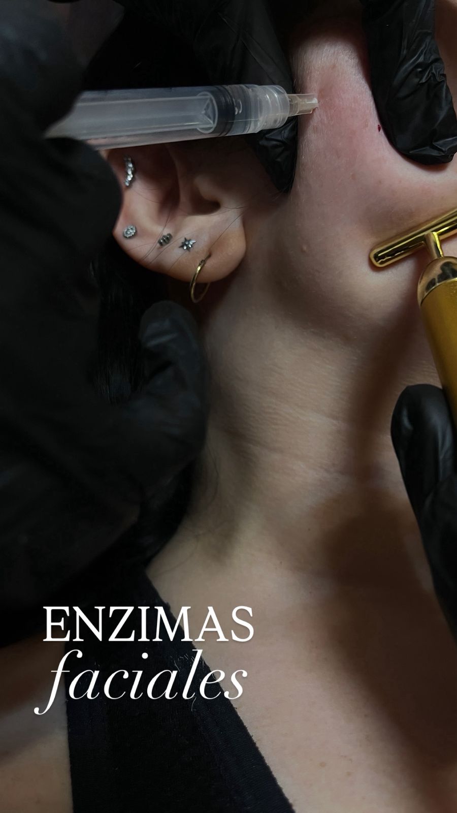 Enzimas faciales en cuello